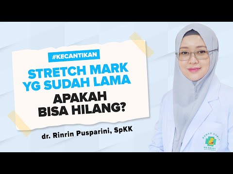 Stretch mark yang sudah lama apakah bisa hilang? dr. Rinrin Pusparini, Sp.KK | Dunia Parenting TV