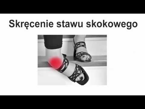 Każdy mięsień nazwie Rozerwana wiązadła mięsień łydki