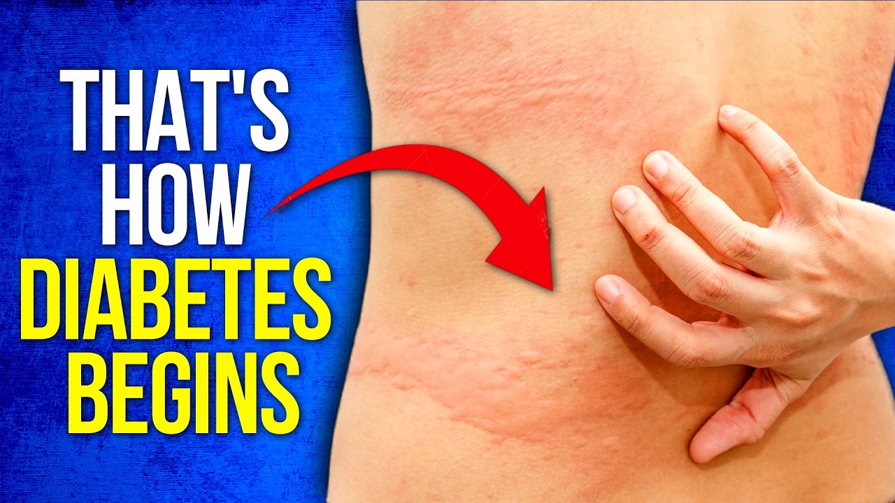 Don't IGNORE These 10 Early Signs Of DIABETES