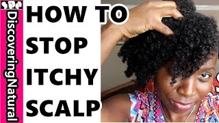 What Causes Itchy Scalp and How to Stop Itchy Scalp