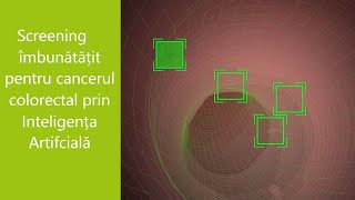 Inteligența artificală în colonoscopie la Spitalul Privat Confraternität
