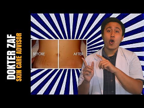 Bungkus di rumah untuk menurunkan berat badan dengan madu Apa mimpi teman pelangsing