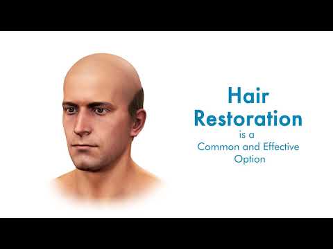 ARTAS 9X Robotic Hair Restoration Animation video. Best Hair Transplant Procedure in Charlotte area