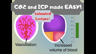 Carbon Dioxide & Intracranial Pressure (ICP): Effects of CO2 on blood vessels.