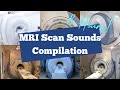8 Hours Of MRI Scan Sounds Every MRI Scan Machine From GE Healthcare