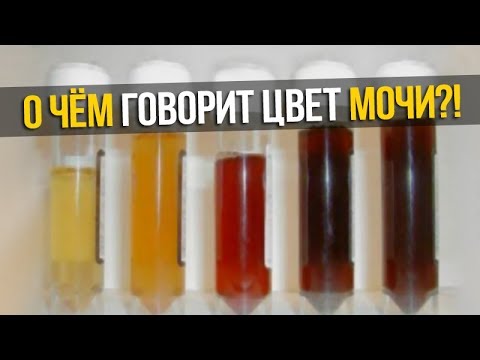 О ЧЁМ ГОВОРИТ ЦВЕТ МОЧИ?!