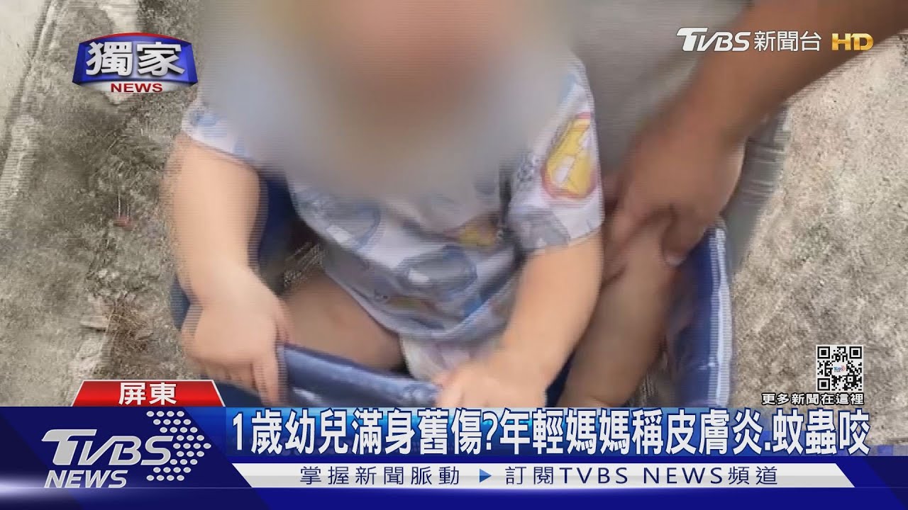 23歲母求救兩童無奶粉 赫見男童大腿疑瘀青舊傷