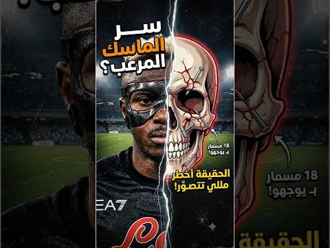 الحقيقة المخفية وراء ماسك أوسيمين! ⚠️ #كرة_القدم #اليورو #كأس_العالم