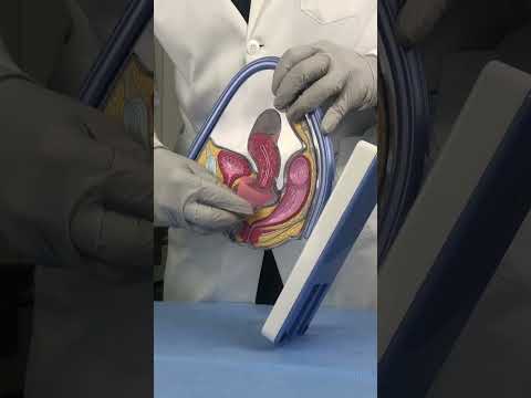 🤷🏻‍♀️🩸Menstrual cups & how they work #menstrualcup #periods #gynecologist #obgyn #menstrualcups