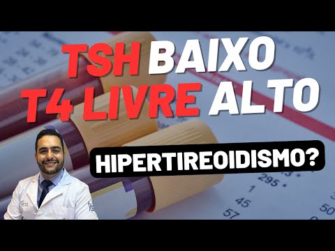 LOW TSH, HIGH FREE T4 - HYPERTHYROIDISM DUE TO GRAVES' DISEASE