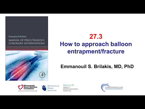27.3 Balloon entrapment and fracture - Manual of PCI