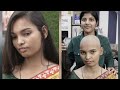Bald For A Beautiful Cause Female Hair Donation Story A Life Changing Transformation ‍ ️ ️