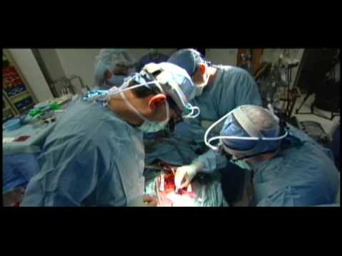 心脏外科医生 - 生活中的一天。