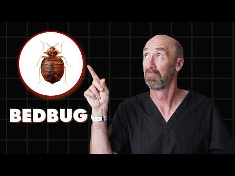 Doctor Explains BEDBUGS-including BITES, TREATMENT, REMOVAL