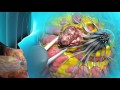Learn About Lumpectomy