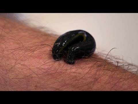 Michael Mosley is bitten by a leech - Infested! Living with Parasites - BBC Four