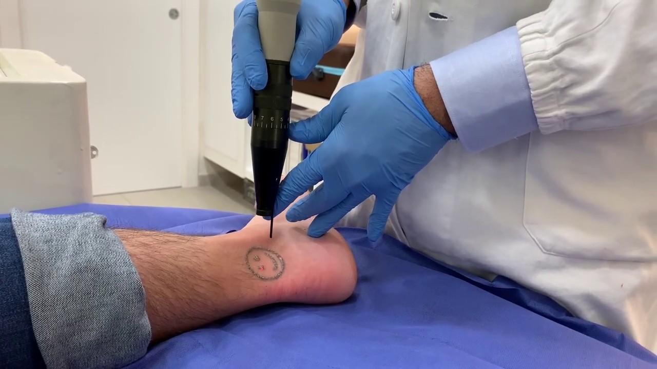 Tommaso Anniboletti-54