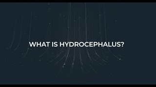 About Hydrocephalus