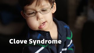 The Rare Condition Doctors Struggle to Explain | Born Different clip | True Lives