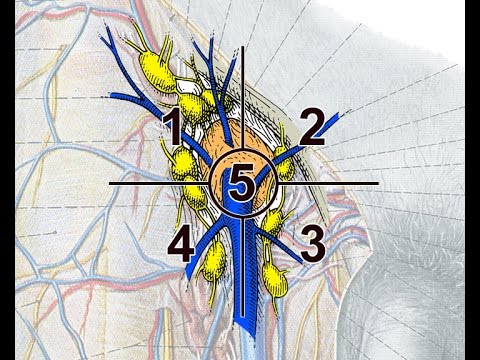 Come trattare la displasia dellanca nei bambini sotto i 5 anni Sport in osteocondrosi e scoliosi