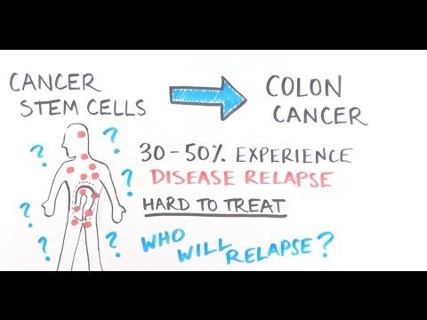 署名、捺印、尊重されています。大腸がんの遺伝的手がかりの発見 (SIGNED, SEALED, RESECTED: Discovering the genetic clues within colorectal cancers.)