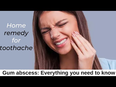 Home remedy for toothache | Gum abscess: Everything you need to know Video