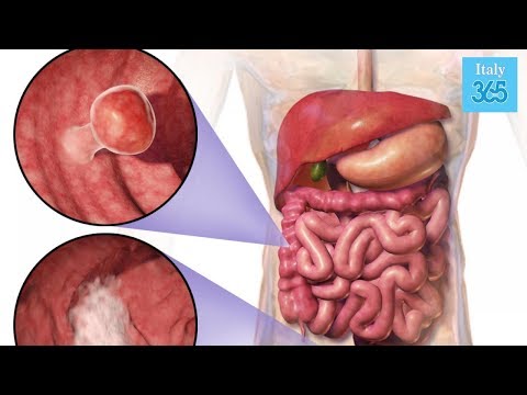 Prezzo di martello di Thor delle farmacie in Ucraina Vendita di dispositivi per lingrandimento del pene