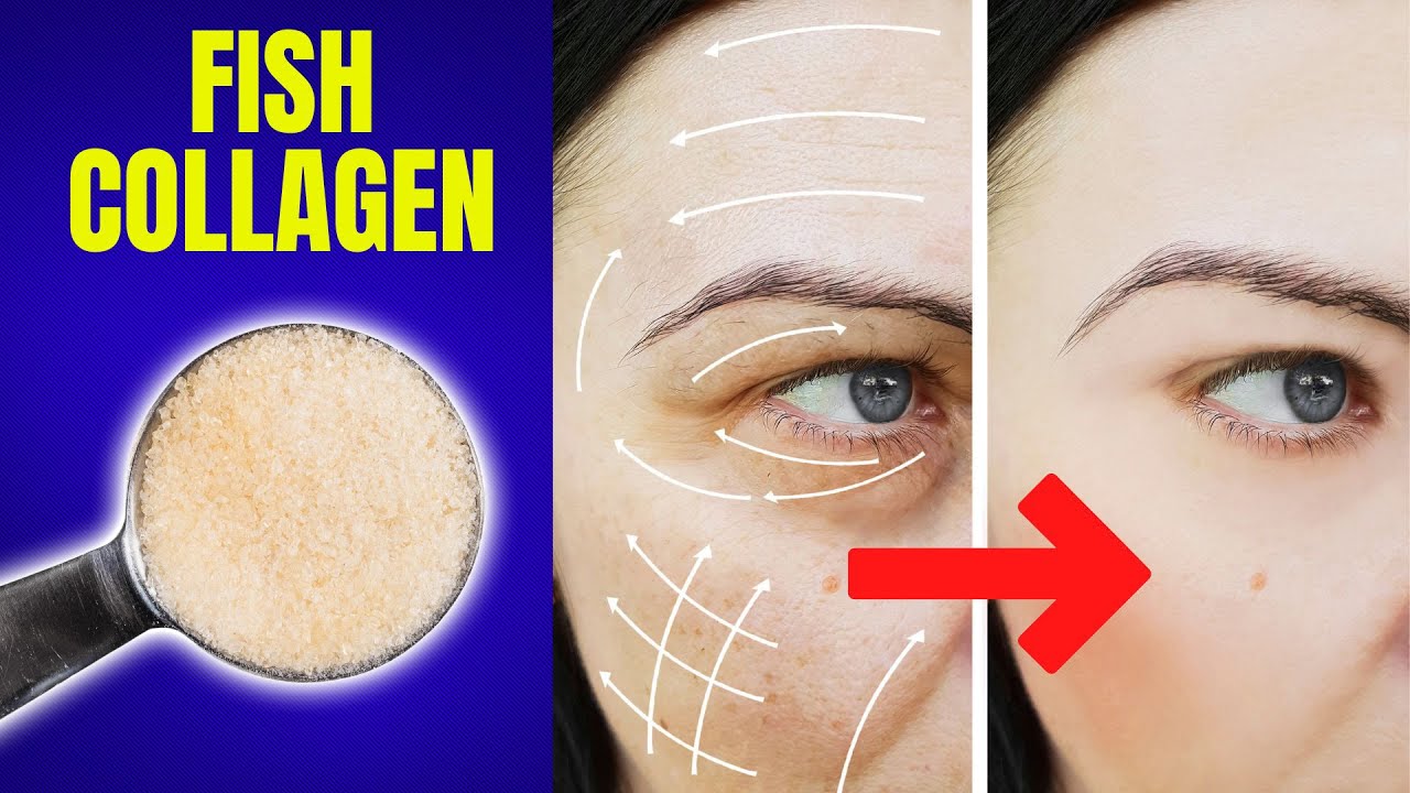 Fish Collagen: Everything You Need To Know