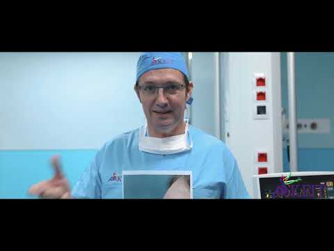 Rimodelimi i hundes #15