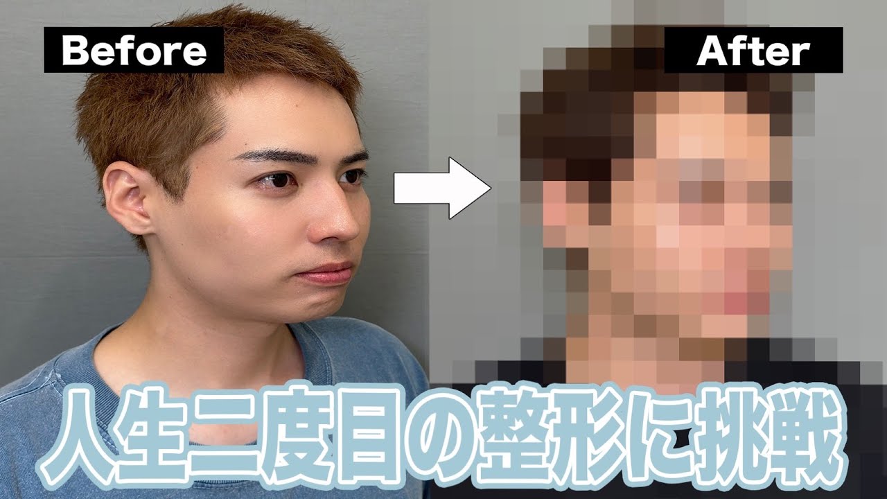 全てのコンプレックスから解消されました。