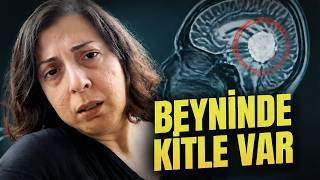 Acildeki Doktor: Beyin Cerrahına Git Beyninde Kitle Var Dedi