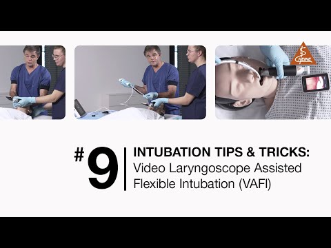 Video Laryngoscopy Assisted Flexible Intubation (VAFI)