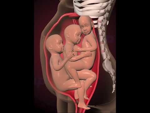 PRECIOUS MOMENTS OF TRIPLETS INSIDE THE WOMB  (3D ANIMATION)
