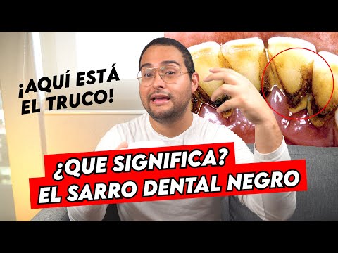 Introducción