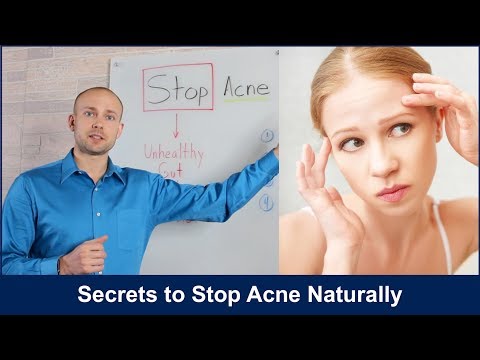 Secrets to Stop Acne Naturally 2018
