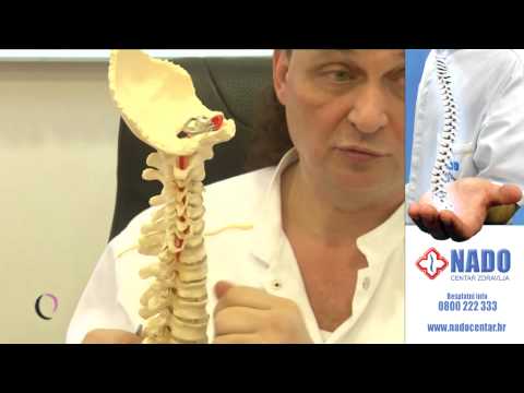 Degenerativne promjene na vratnoj kralješnici