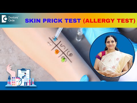 Allergy Skin Tests | SKIN PRICK TEST - How is it performed? - Dr.P Lakshmi Satish | Doctors' Circle