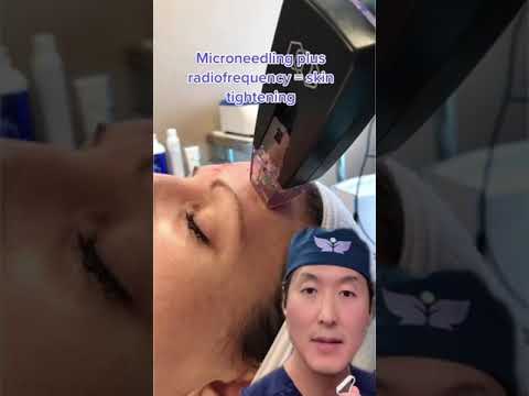 A New Way To Tighten Skin- Morpheus Radiofrequency Microneedling #shorts #morpheus