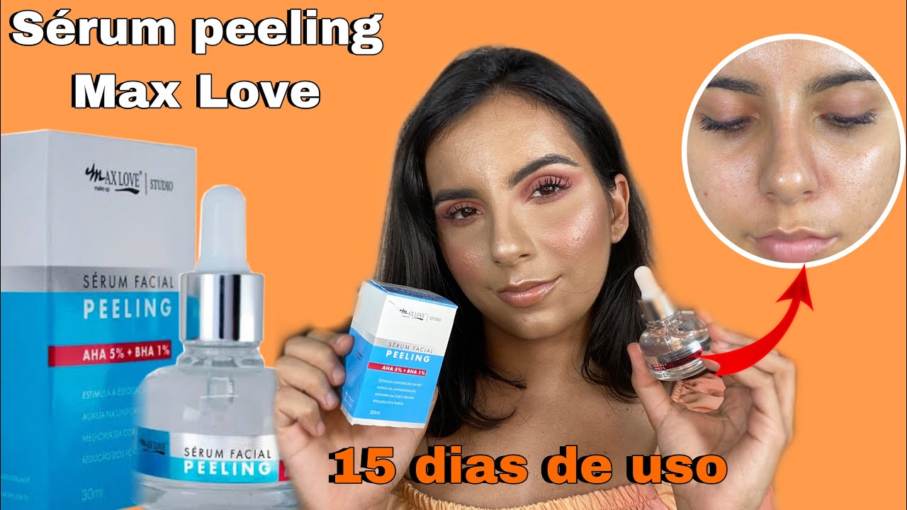 TESTEI por 15 DIAS o SÉRUM PEELING da MAX LOVE! | Resenha