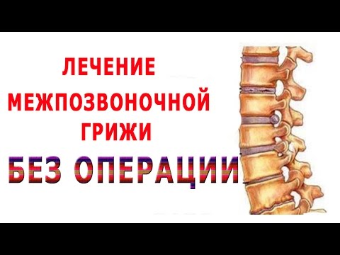 Ich sorge mich um Rückenschmerzen in der linken Seite, dass es so sein kann Obkalyvanie Ozon Osteochondrose