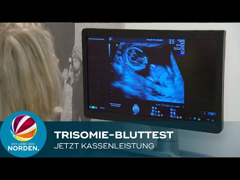 Umstrittener Trisomie-Bluttest für Schwangere jetzt Kassenleistung