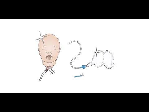 Resusci Baby QCPR - How to Upgrade to Airway Head