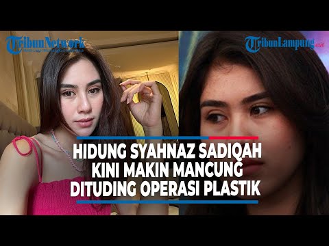 HIDUNG SYAHNAZ SADIQAH KINI MAKIN MANCUNG, DITUDING OPERASI PLASTIK
