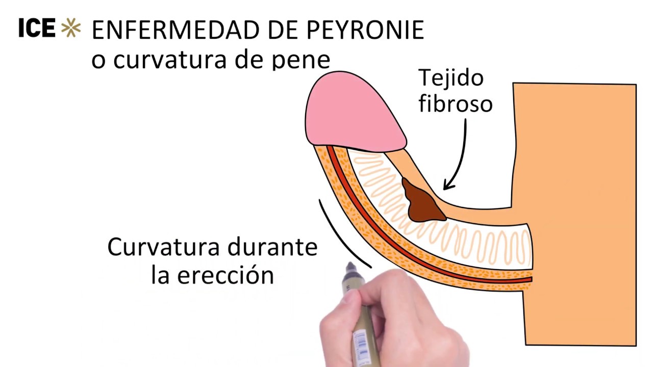 Juan Ignacio Martinez-Salamanca-18