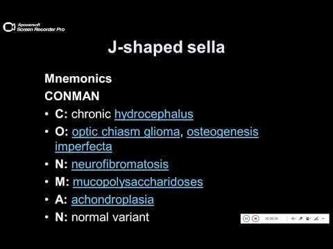 Quiz powerpoint video case 150