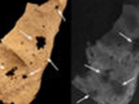 3,000-year-old skeleton found riddled with cancer