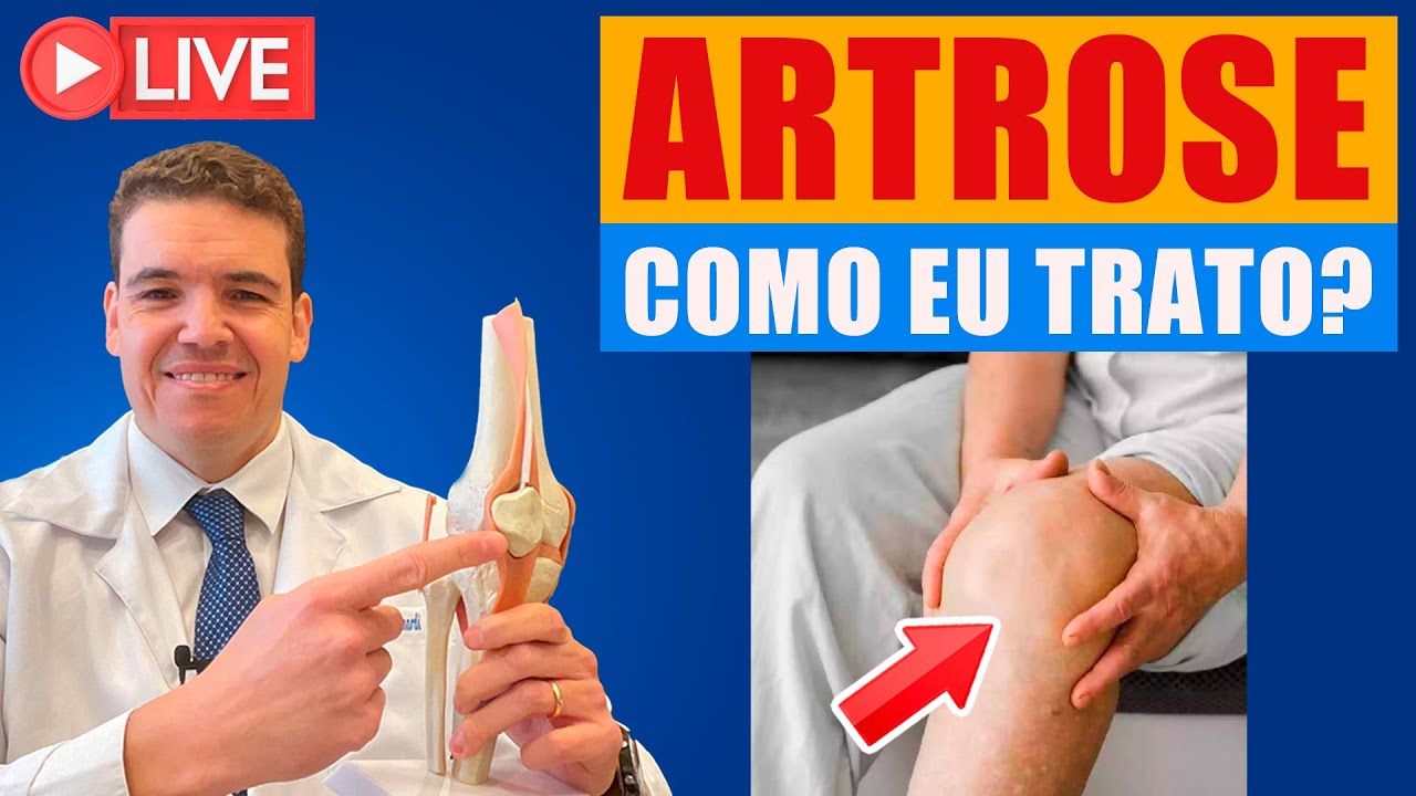 [LIVE] ARTROSE, como eu trato?