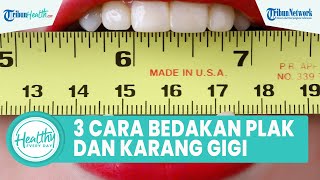 3 Cara Membedakan Plak dengan Karang Gigi yang Bisa Ganggu Kesehatan Gigi: Kurangi Makanan Manis