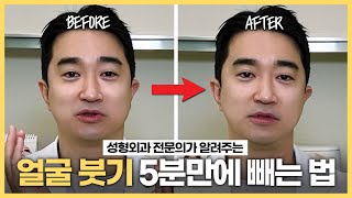 (빠른 효과 보장) 얼굴 붓기 빨리 빼는 법! 성형외과 전문의가 알려드립니다