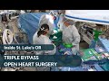 WATCH Triple Bypass Open Heart Surgery